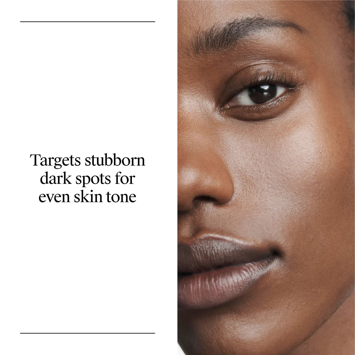 Neutrogena® Rapid Tone Repair Retinol + Vitamin C Dark Spot Corrector, 1 Oz - US 2927