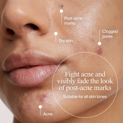 Neutrogena® Acne-Fighting Skincare Solutions Regimen Duo - US 2656