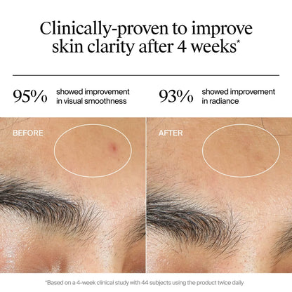 Neutrogena® Evenly Clear™ Acne Gel Moisturizer, 1.7oz - US 0712